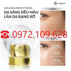 Review Kem nám Melasma Huyền Phi chính hãng